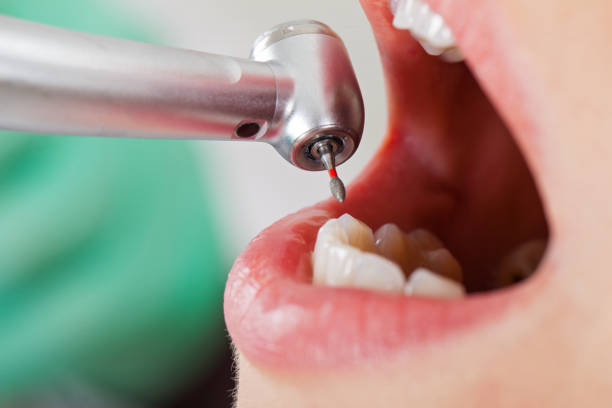 Best Emergency Dental Care for Sports Injuries in South Greeley, WY